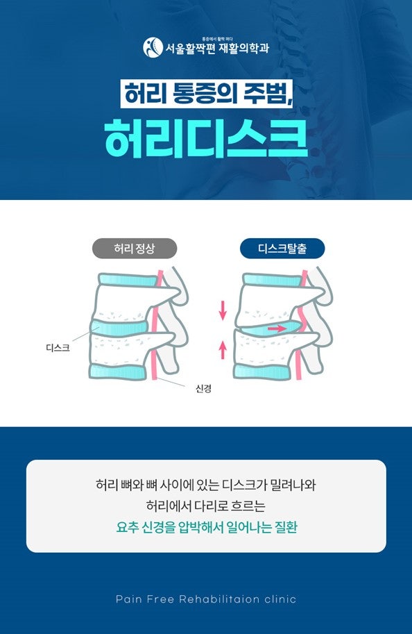 Robotic Decompression Therapy — 본문 그림