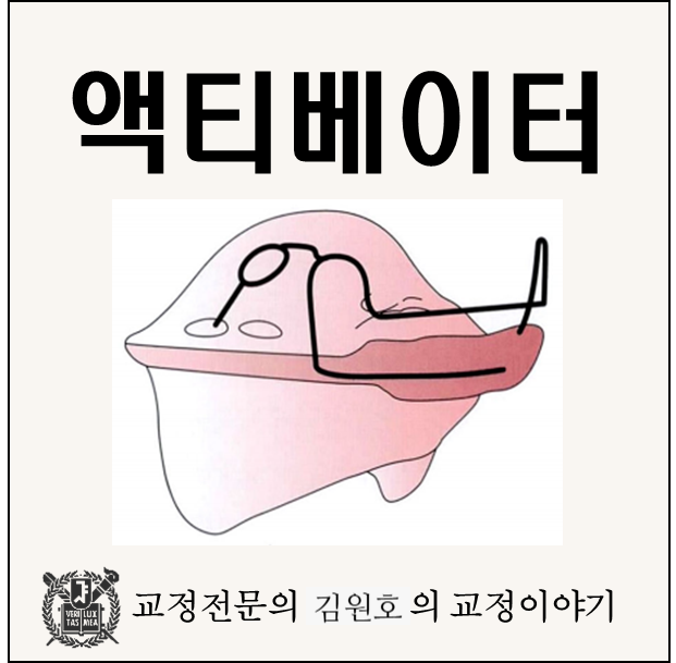 Activator 액티베이터 근신경계 자극을 하는 가철식 교정장치
