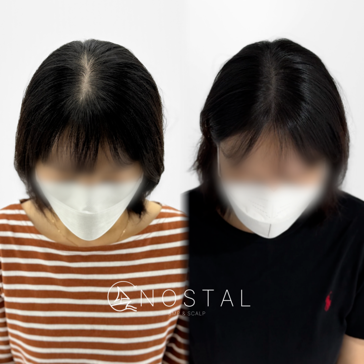  두피문신 수강, 외모 관리의 중요성과 두피문신 창업의 기회