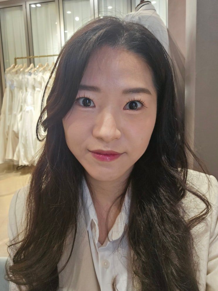  삼성역피부과 리니어지 리프팅 후기
