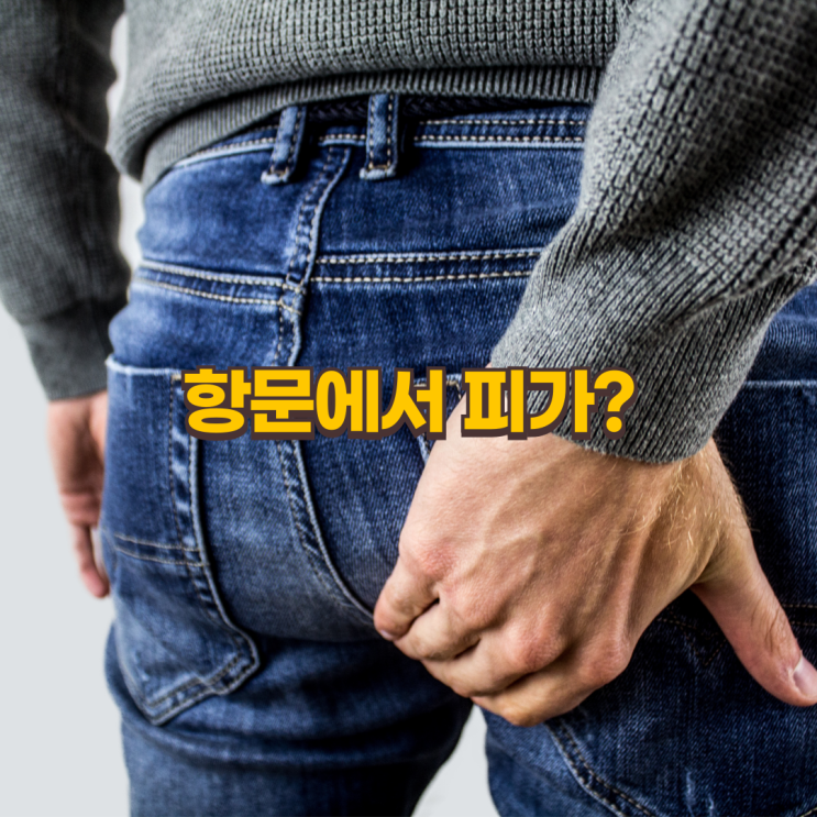  항문 출혈, 치질? 치열? 대장 내시경 검사가 필요한 이유
