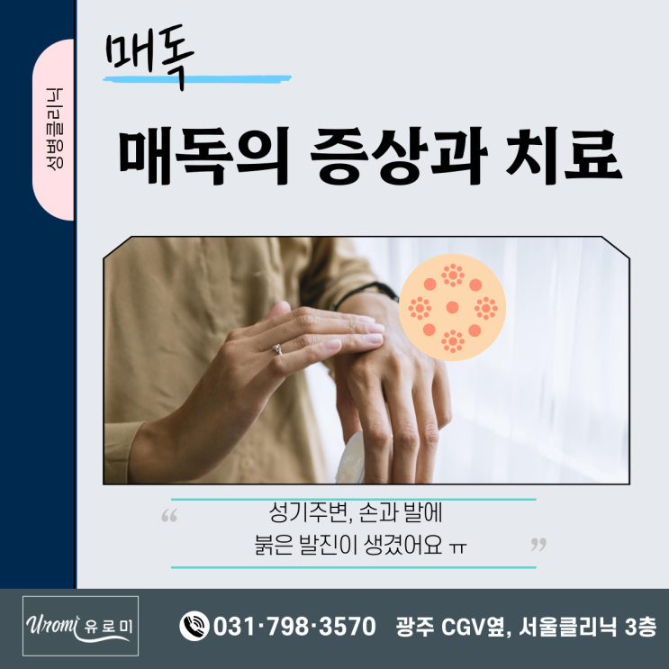  매독 증상과 치료: 광주비뇨기과