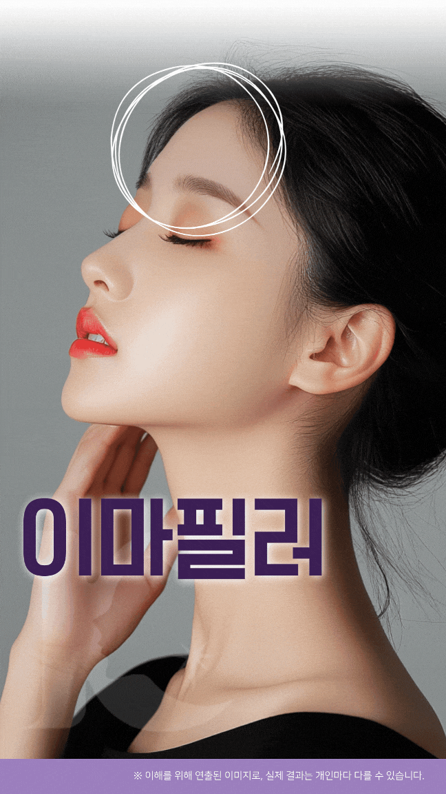  광주이마필러 지방이식과 다른점은 수완지구 성형외과에서