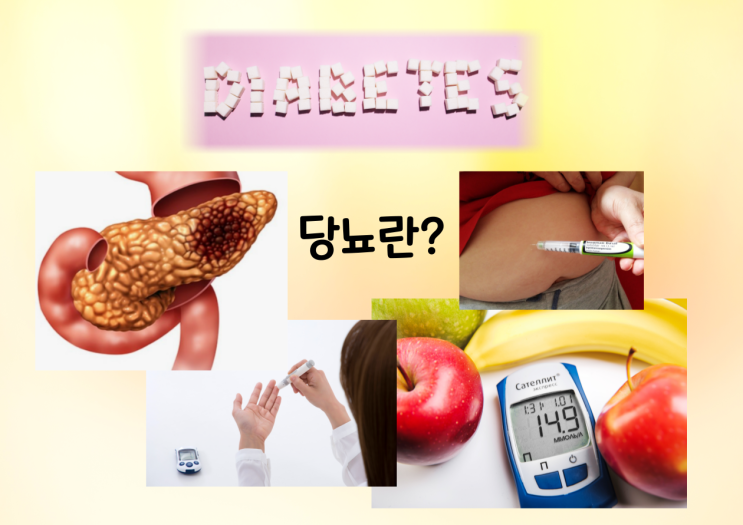  당뇨병이 발생하는 원인과 예방 방법