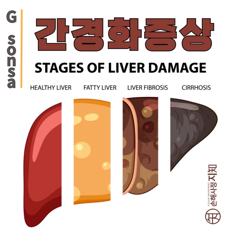  간경화 증상 - 소화불량과 무기력감, 위험 신호일 수 있습니다. - [간암, 6부]