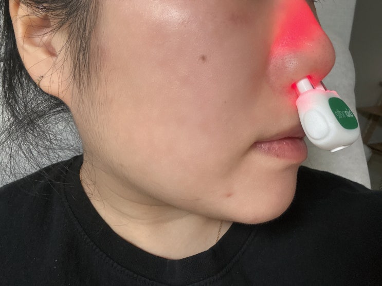  임산부 임신중 비염 코막힘 콧물 재채기 숨막힘 해결하기