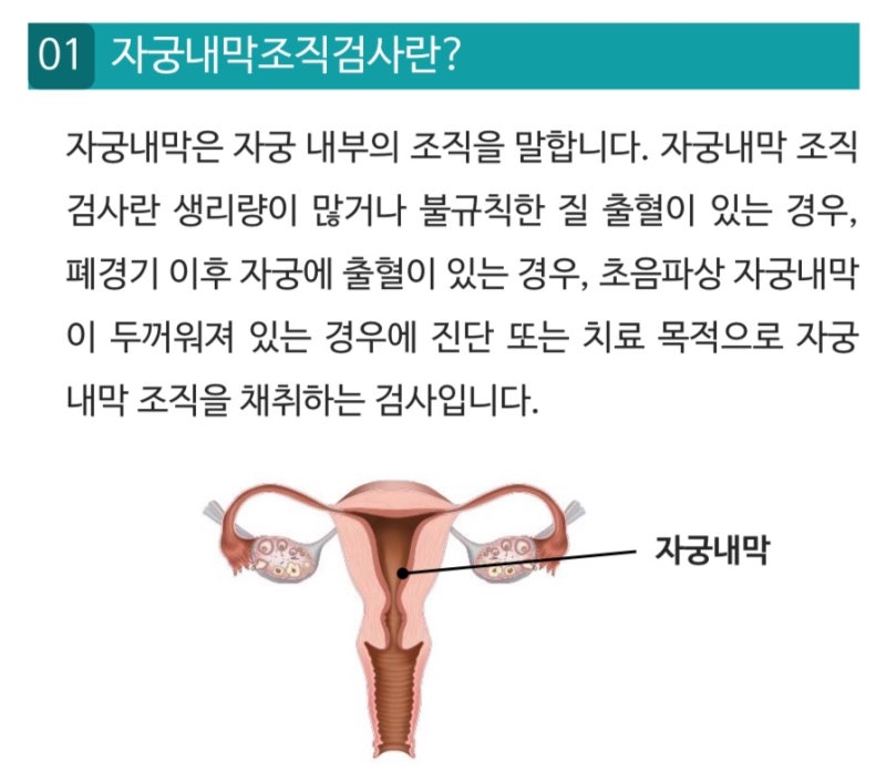 아산병원 자궁내막증식증 소파술+미레나 시술 후기 및 금액 (+실비)