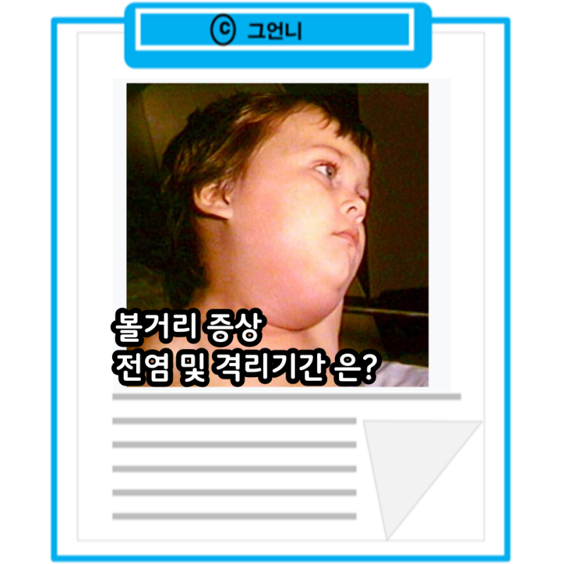 볼거리 증상 전염 격리기간 바이러스백신 예방접종 검사