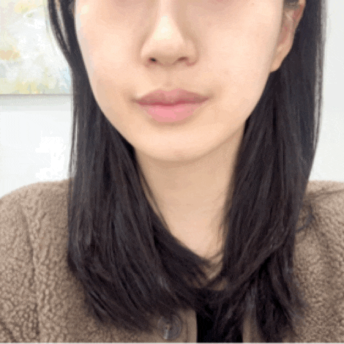  강남역 에스테틱 좁쌀여드름 피부관리 가성비 좋은 피에르에스테틱