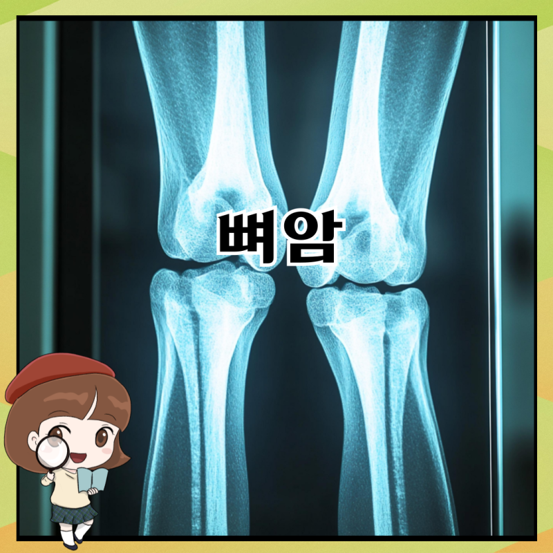 뼈암 증상 진단 과정 치료방법은?