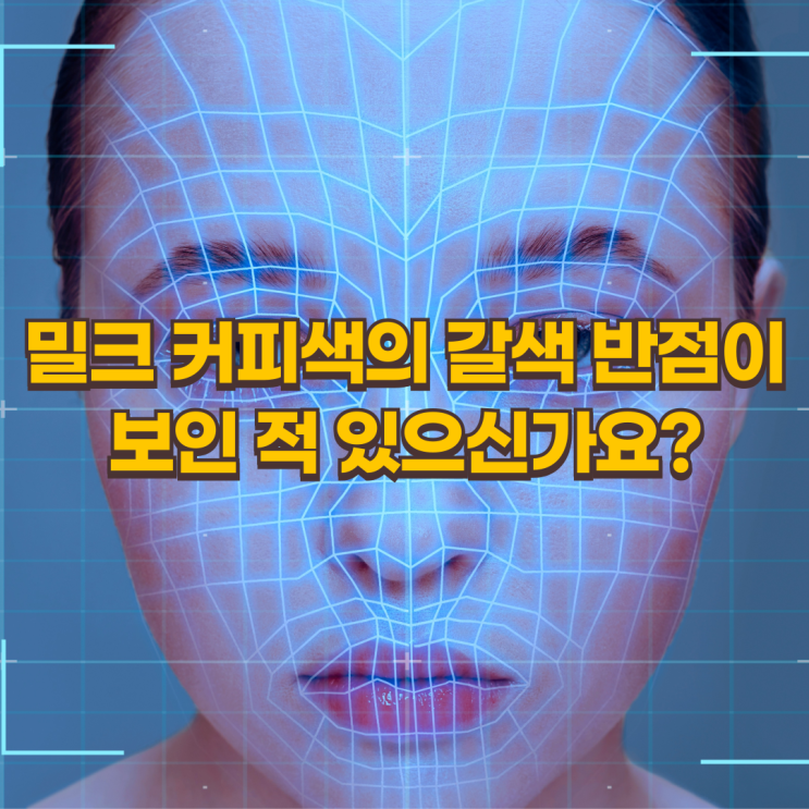  카페오레 반점, 치료는 언제 시작해야 효과적일까?