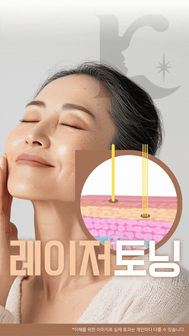  광주 피코토닝 기미잡티 나노레이저와 다른점 수완지구에서