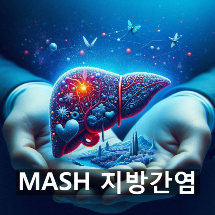  MASH(메타볼릭 활성 지방간염)란? 증상 및 특징, 치료 및 예방 관리방법 등