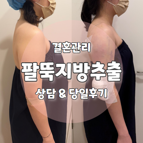  W6. 교대역 팔뚝 지방추출주사 상담 및 시술당일 찐후기