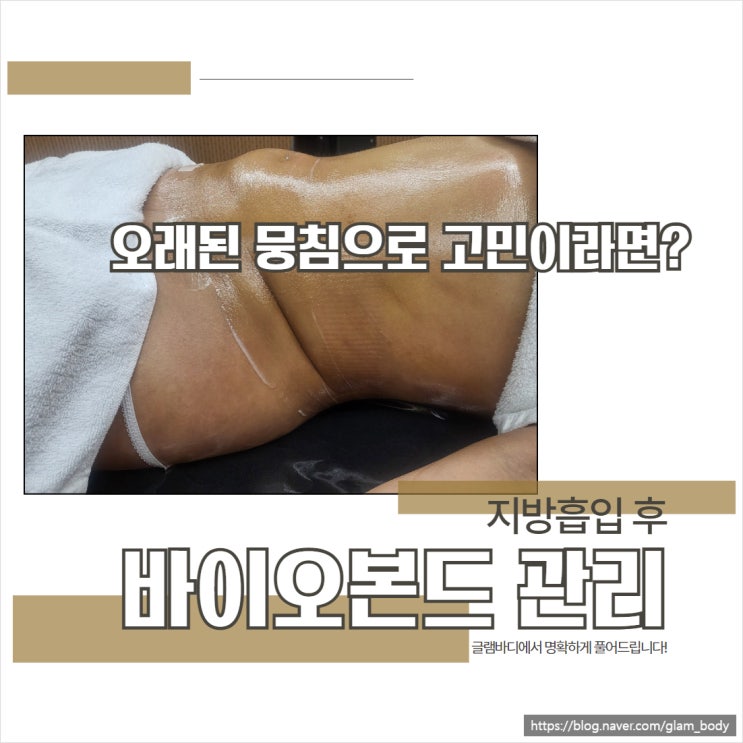  바이오본드관리 오래된 뭉침으로 고민이시라면?