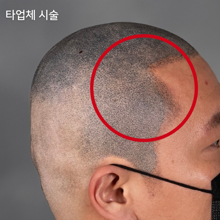  두피문신 수강료 저렴한데 알아보고 있다면 필독
