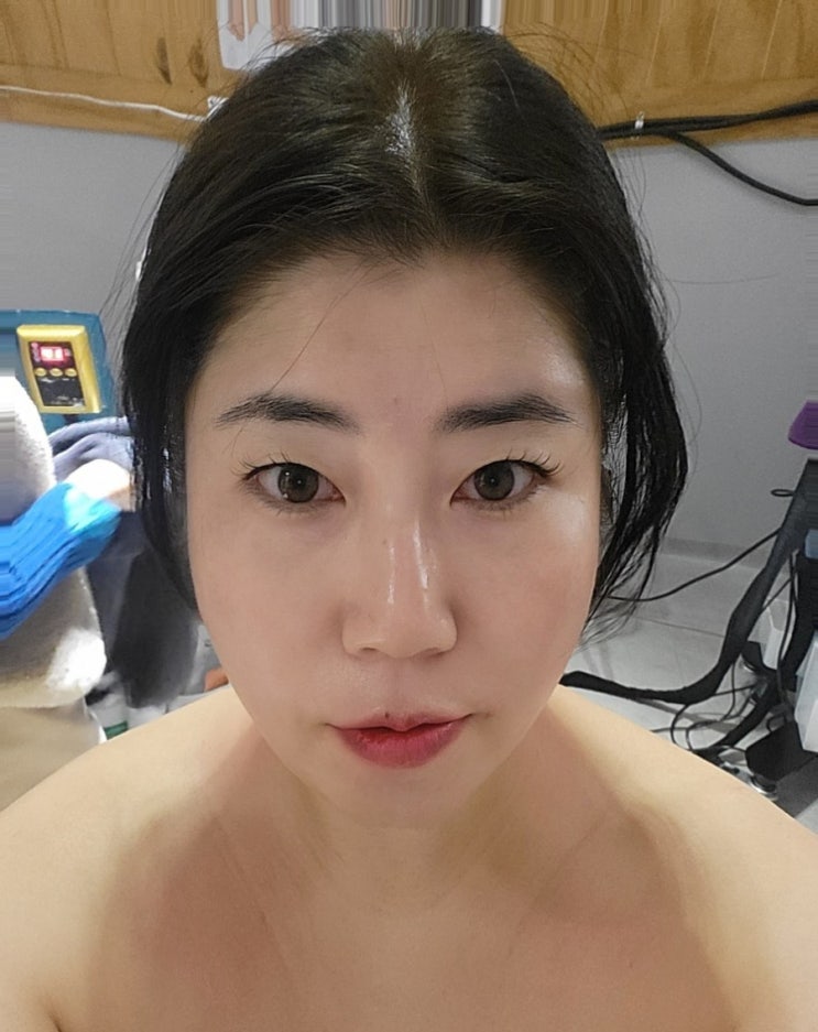  [김해어방동]윤곽관리 전후가 확실한 김해피부관리 '이연진스킨앤바디'