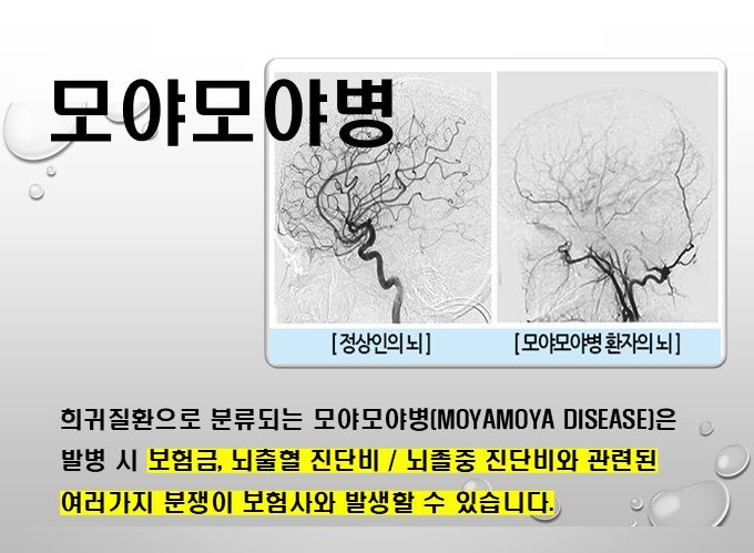 [보험] 모야모야병 보험사와의 분쟁(보험금 부지급) 해결