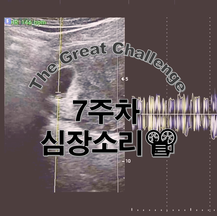  7주차 심장소리 들었지만 갈색혈과 주수보다 늦은 아기