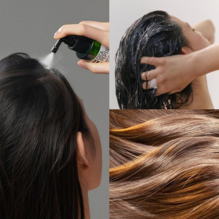  비듬, 두피스케일링으로 해결! 두피각질원인, 머리비듬없애는법, 두피스케일링제품추천