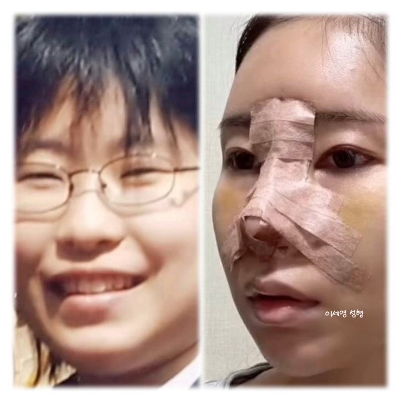 개그우먼 이세영 얼굴전체 성형 유튜브 수익 공개!