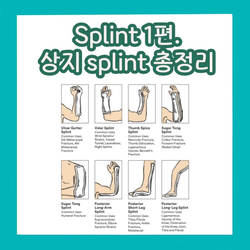 [응급실간호] splint 종류 1편. 상지 splint, armsling 총정리 : 네이버 블로그