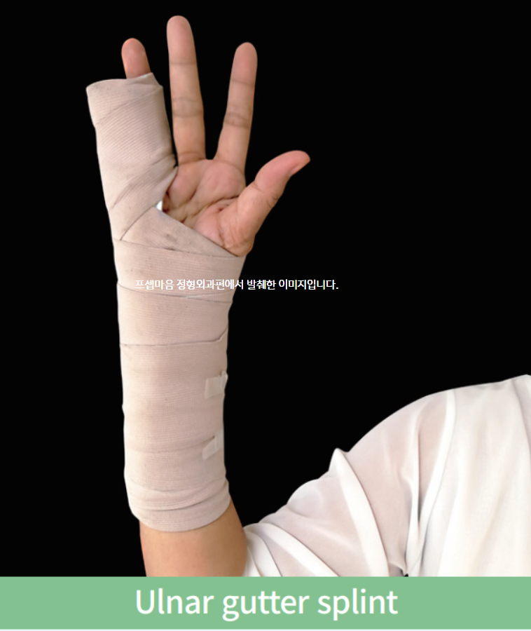 [응급실간호] splint 종류 1편. 상지 splint, armsling 총정리 : 네이버 블로그