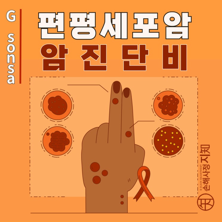  편평세포암 보험금 완벽 가이드 - 약관과 조직검사로 5배 더 받기 - [피부암, 2부]
