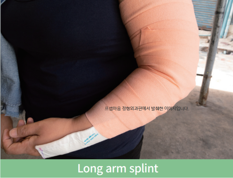 [응급실간호] splint 종류 1편. 상지 splint, armsling 총정리 : 네이버 블로그