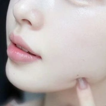  피부 얼굴 하얘지는법 총 정리 : 화이트닝 레이저 에센스 홈케어 등