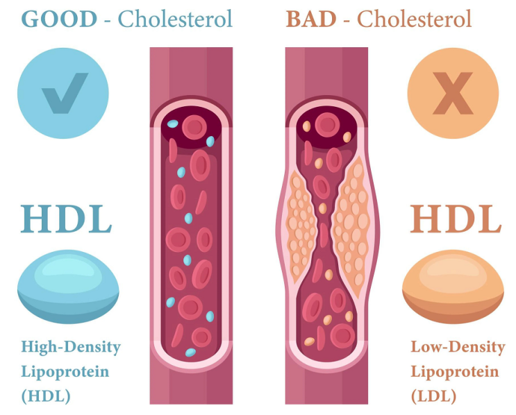  HDL LDL 뜻, 나쁜 콜레스테롤 낮추는 방법 (# LDL 콜레스테롤 130 160)