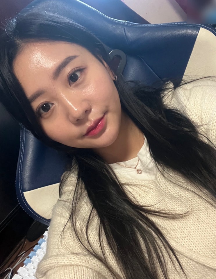  명동역비만클리닉 심부볼지방분해주사 얼굴 효과 통증 당일붓기 1회차 후기