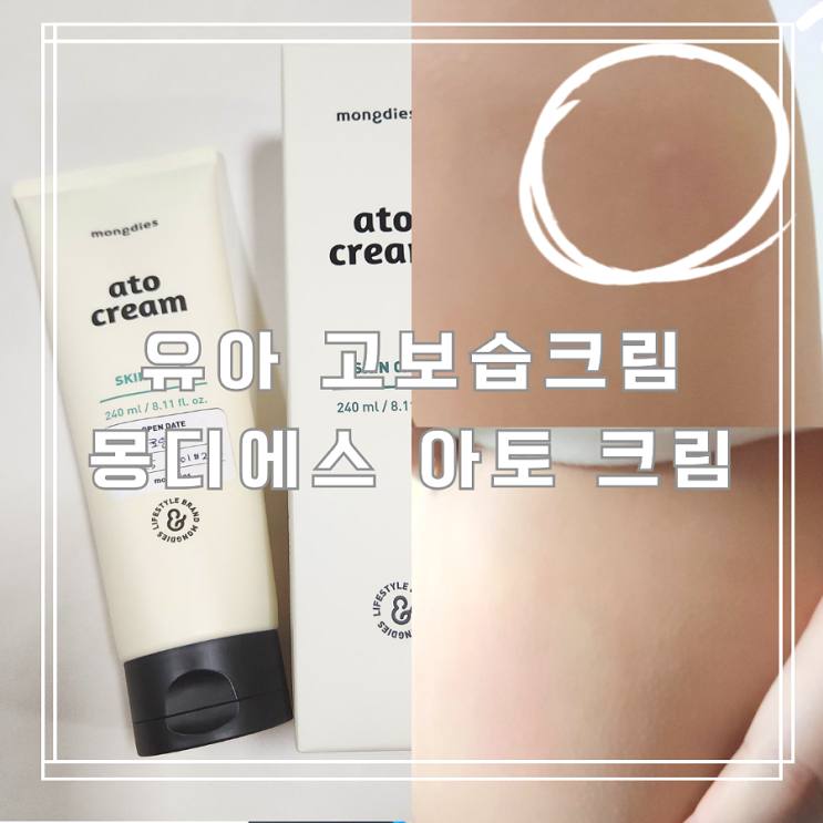  가려운 피부를 위한 아기크림추천 유아고보습크림 몽디에스 아토크림