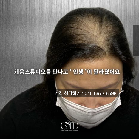  광주 두피페인팅과 두피문신 차이점 확실하게 알자