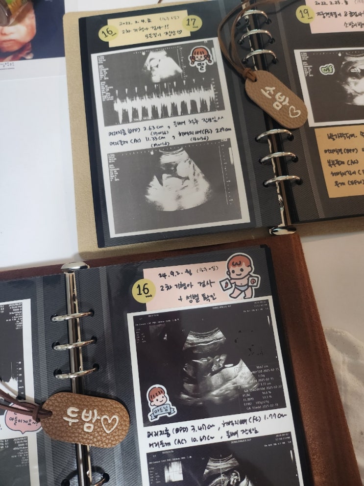  첫째 둘째 초음파 앨범 정리 꿀팁! 소중한 기록을 예쁘게 남기는 법