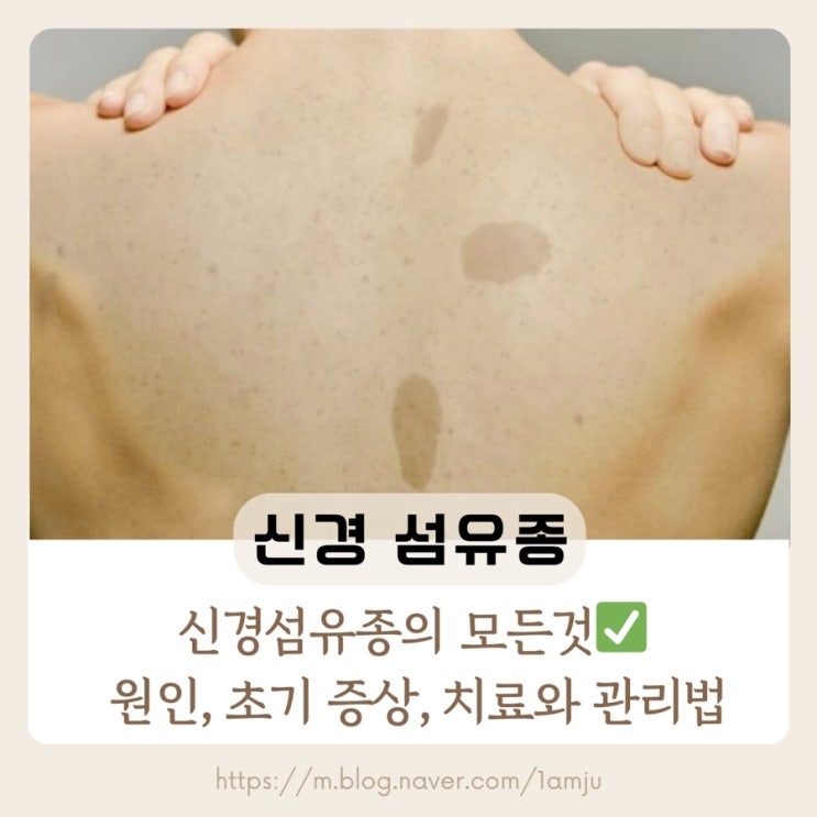  신경섬유종 갈색반점 원인 증상 치료