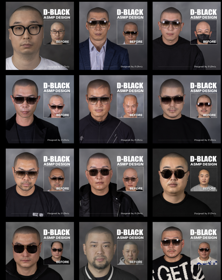 두피문신 잘하는곳 광고글 믿으면 안됩니다