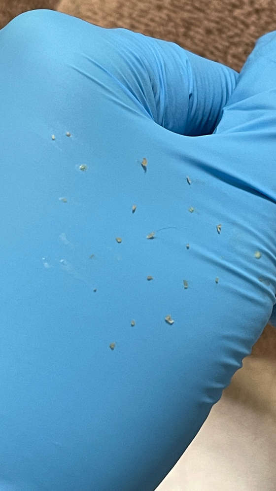 디두로잉 사진 6