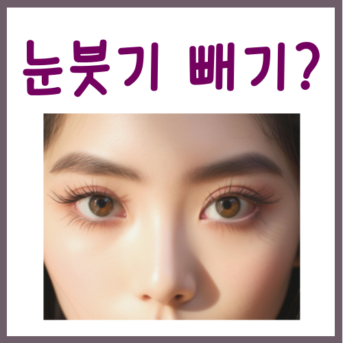  눈붓기 빨리 빼는법? 딱 3가지 방법만 알면 충분합니다