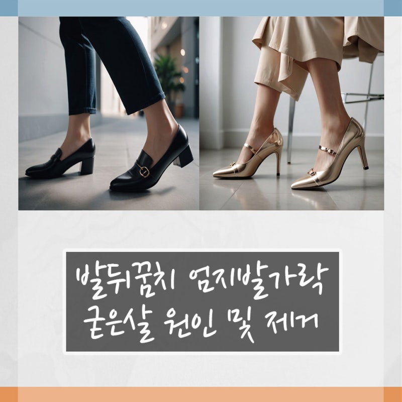 발뒤꿈치 엄지발가락 굳은살 원인 및 제거