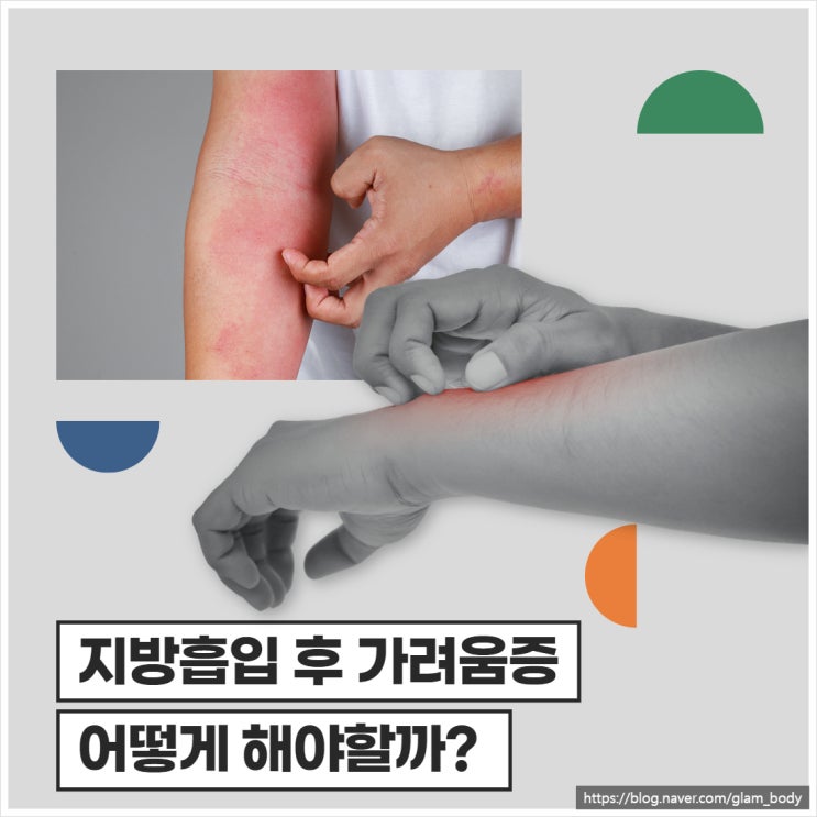  지방흡입 후 가려움증 어떻게 해야할까?