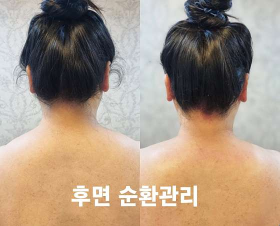 송은미스킨케어 사진 2