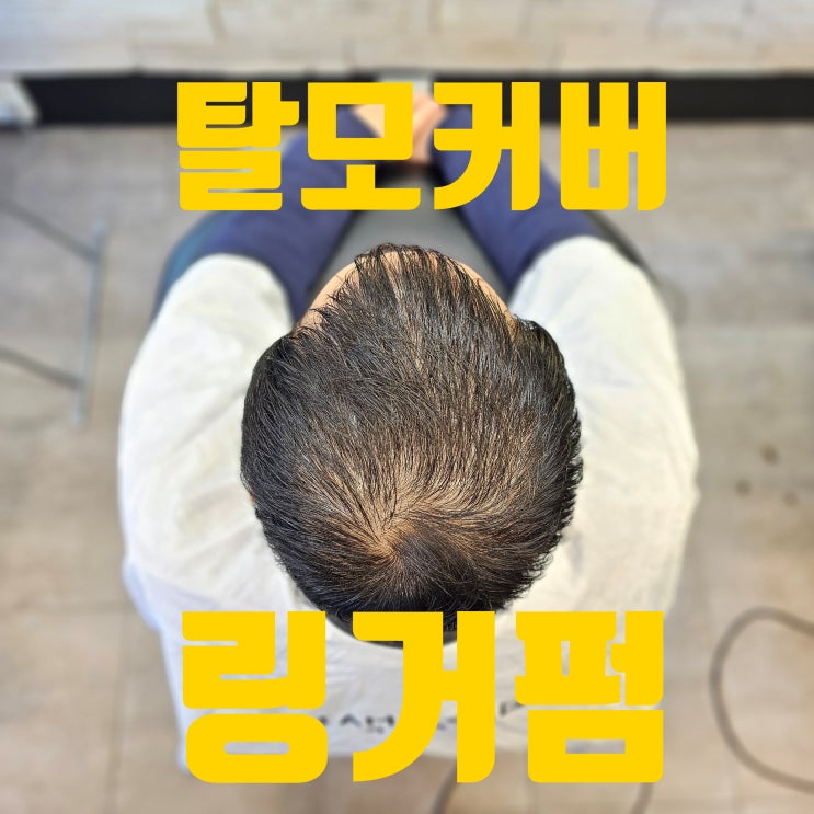  자연스럽게 스타일 완성! 남자 탈모커버펌 & 링거펌 추천