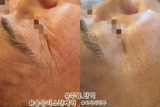 송은미스킨케어 사진 3
