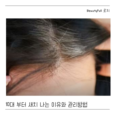  10대부터 새치 나는 이유와 관리 방법