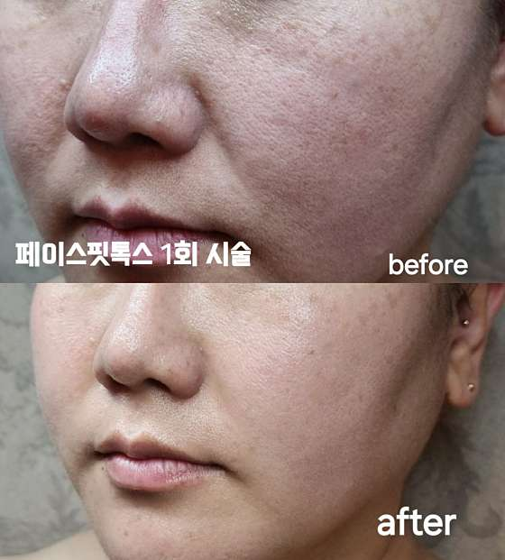 송은미스킨케어 사진 5