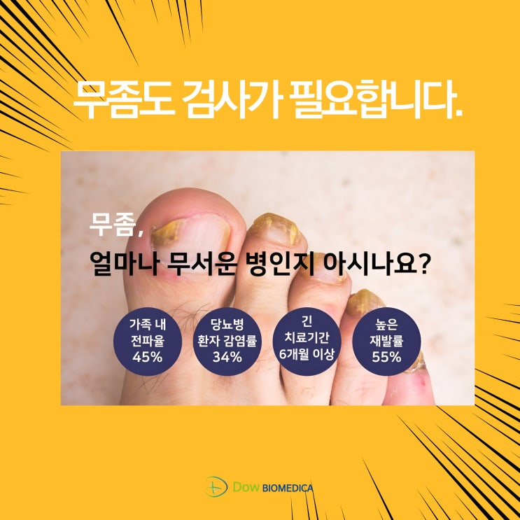  손발톱무좀(손발톱백선증) 신속항원검사 Diafactory : 무좀도 검사가 필요합니다.