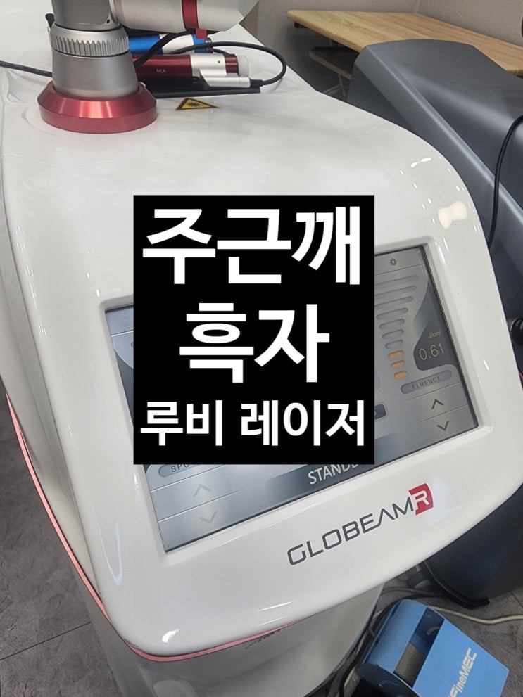  주근깨 흑자 레이저로 없애는 법 루비가 답! 안산피부과 (의사가 직접쓴 의학정보)
