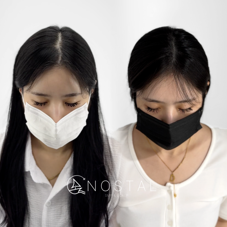  대전SMP두피문신 가격보다 중요한 것