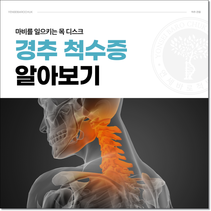  성수동 신경외과 최신 치료법과 기술 안내